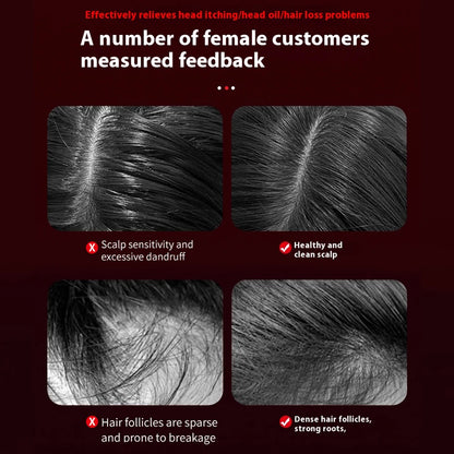 Electric Vibration Massage Comb Massage Scalp Brush Applicator Inject Essential Oils Scalp Care & Hair Care